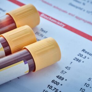 Lab testing kits